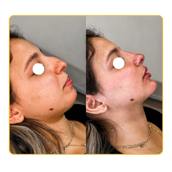11~5