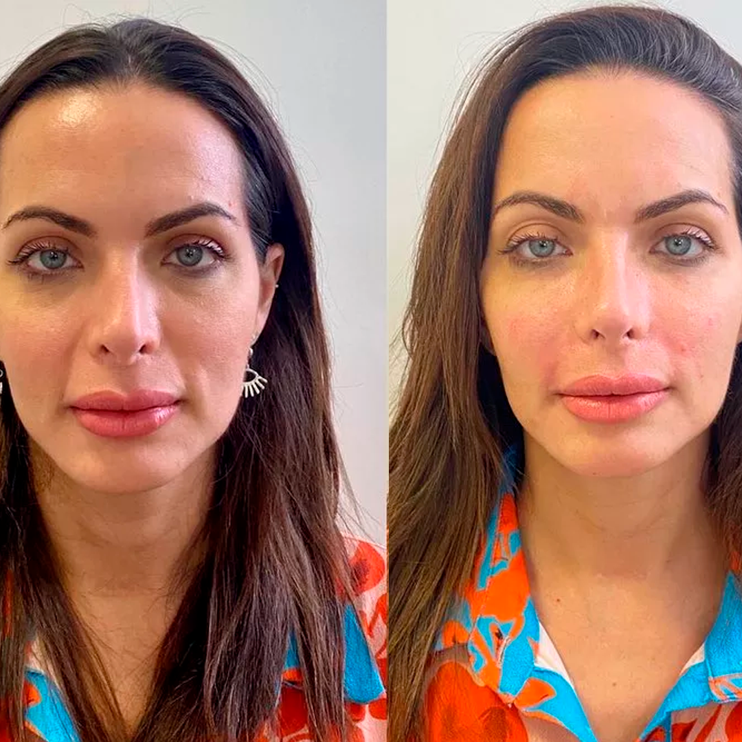 before-after02