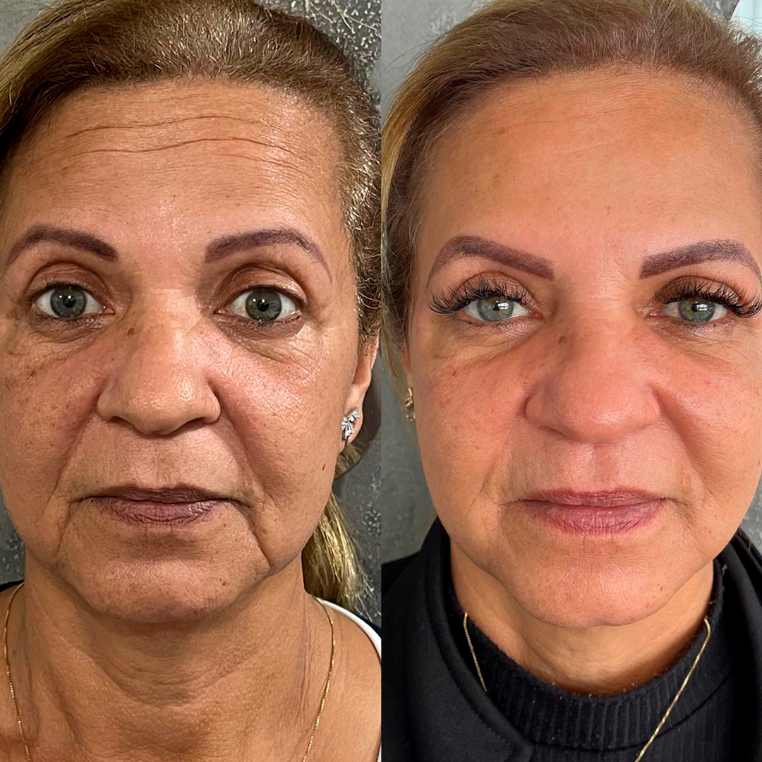 before-after03