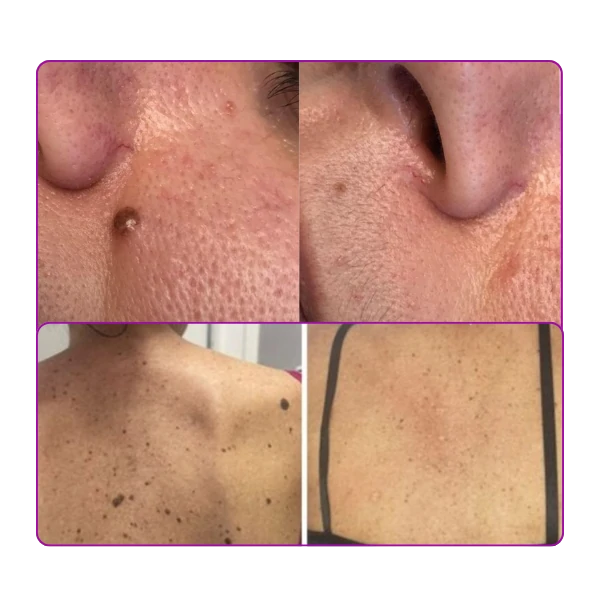 antes e depois_landinpage (1)