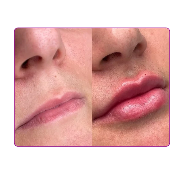 antes e depois_landinpage